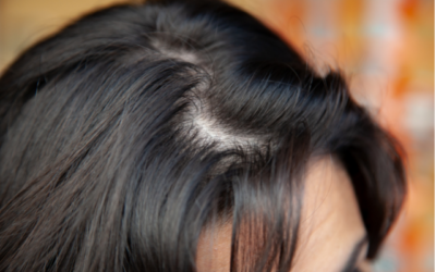 What Causes Hair Buildup